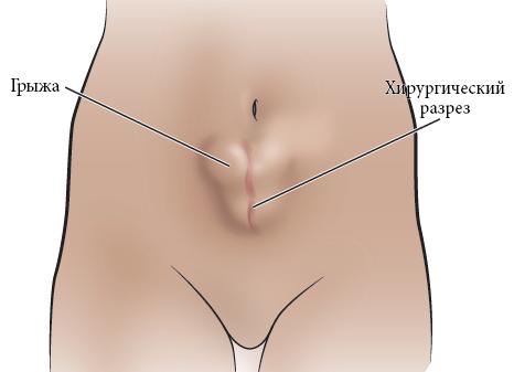 Как перезапустить диету, если она перестала работать. Особенности рефида