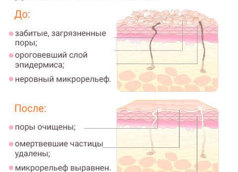 Пилинг-скатка: что это и зачем нужен?