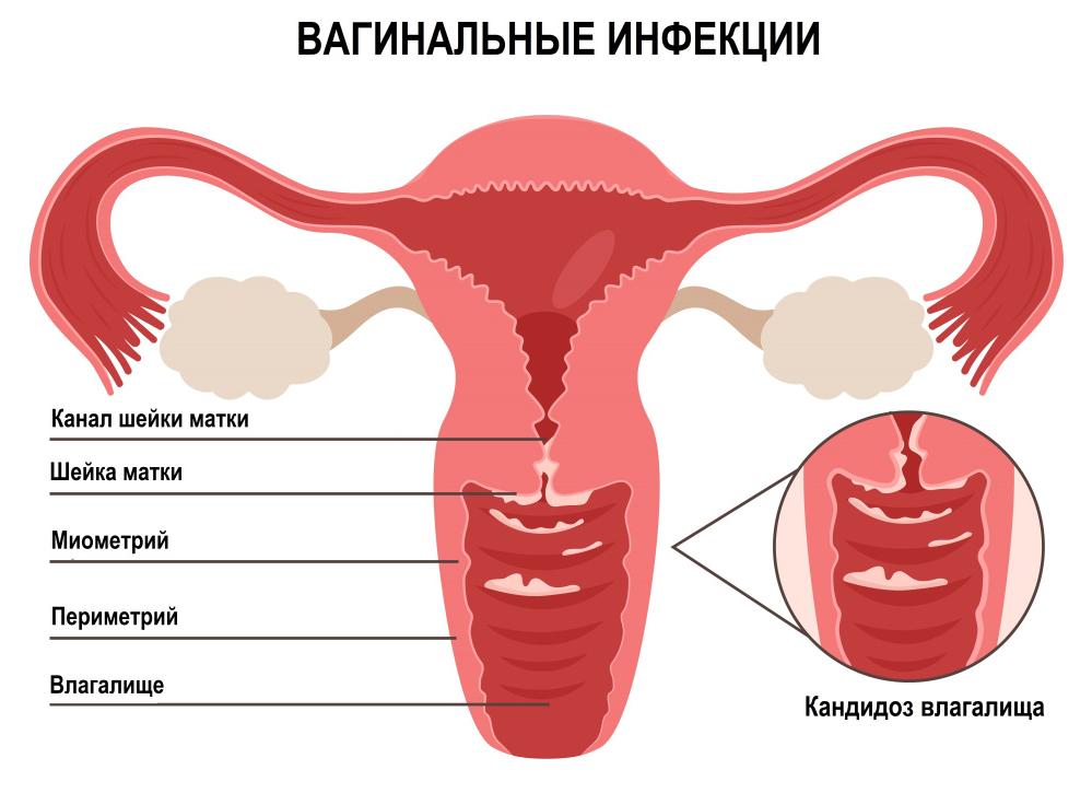 Бели: причины появления