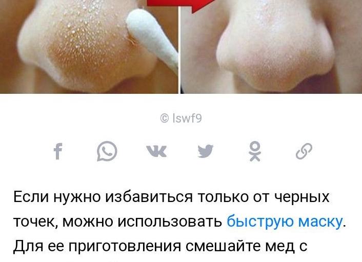 Как избавиться от черных точек? 10 лучших средств