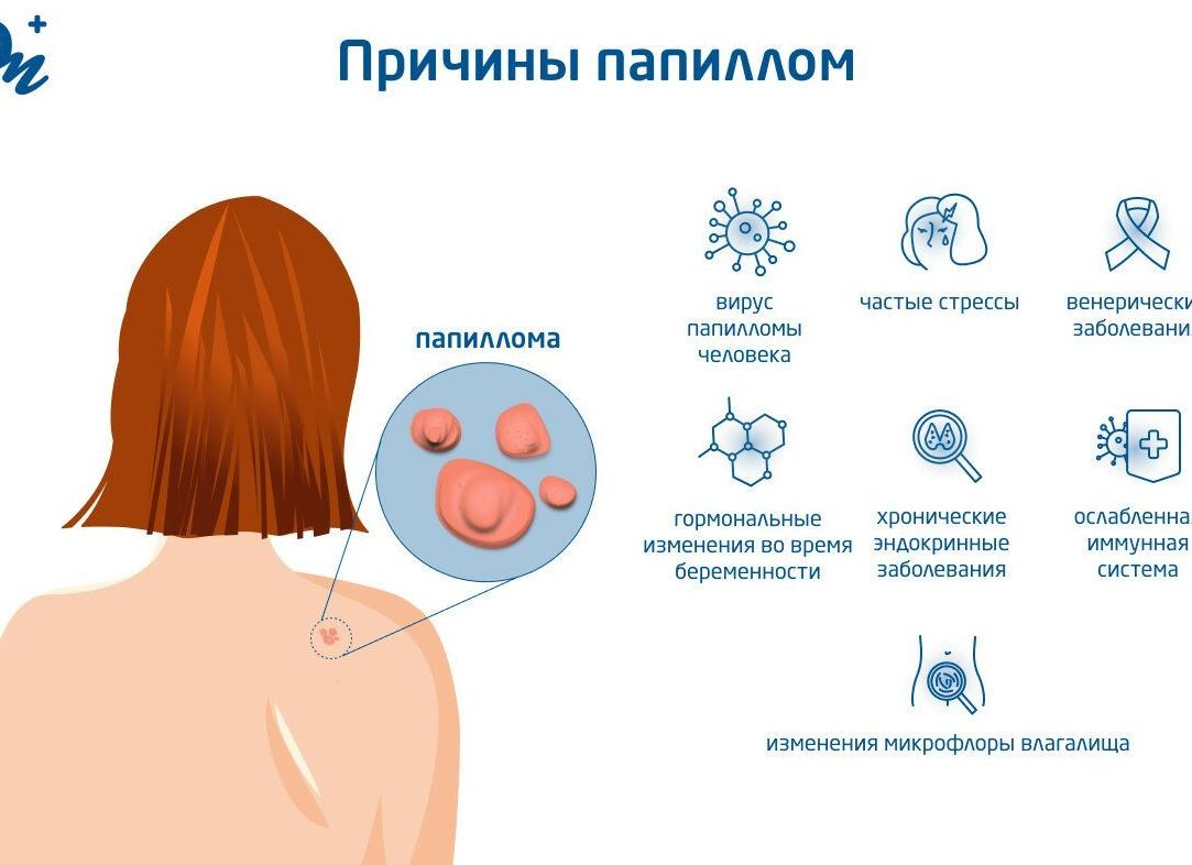 ВПЧ – что это?