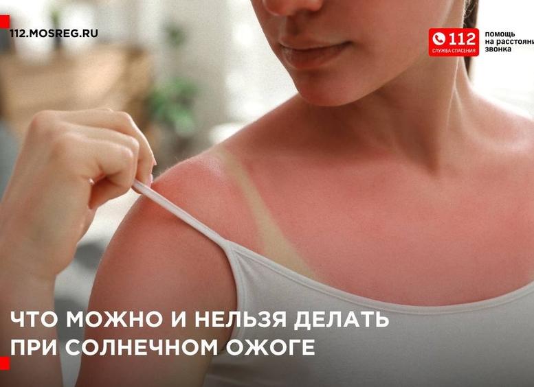 Что нельзя делать при солнечном и термическом ожогах
